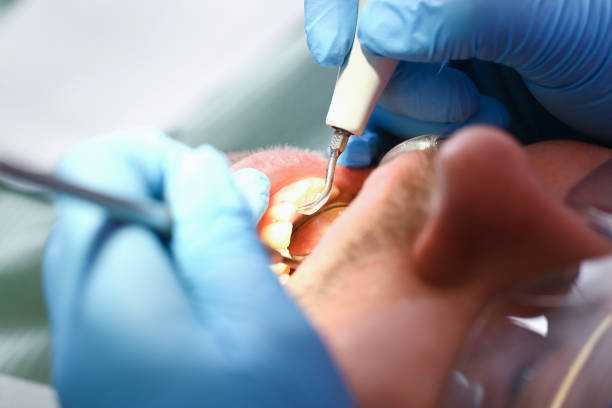 Best 24-Hour Emergency Dental Care in University Of Virginia, VA